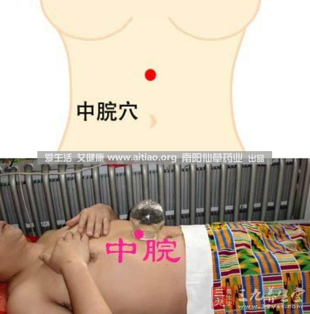 中脘穴位于腹部正中線，臍上4寸的位置上。每天艾灸10-15分鐘，能有效緩解胃部不適的癥狀，同時(shí)有助于祛濕。